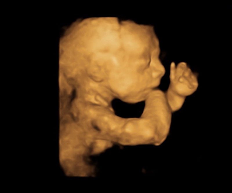 baby 3D ultrasound imaging