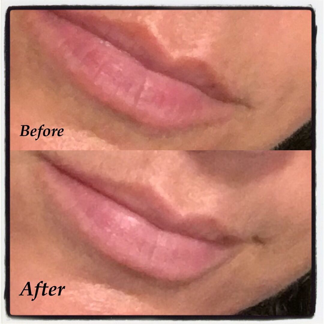 lips