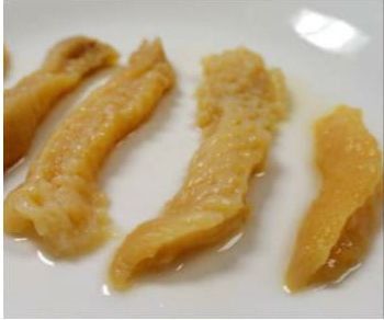 Surf Clams