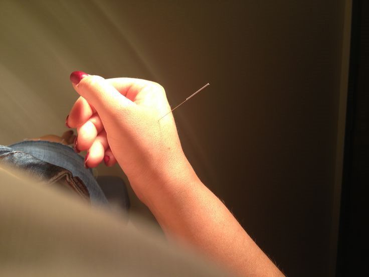 Acupuncture