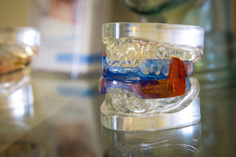 artificial teeth