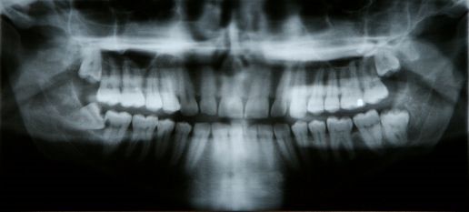 dental xray