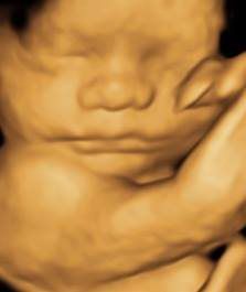 baby 3D ultrasound imaging