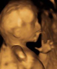 baby 3D ultrasound imaging