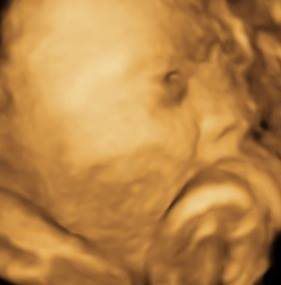 baby 3D ultrasound imaging