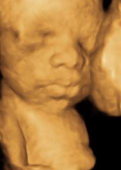 baby 3D ultrasound imaging