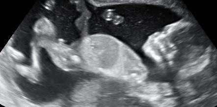 baby ultrasound imaging