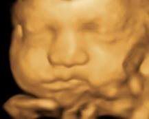 baby 3D ultrasound imaging