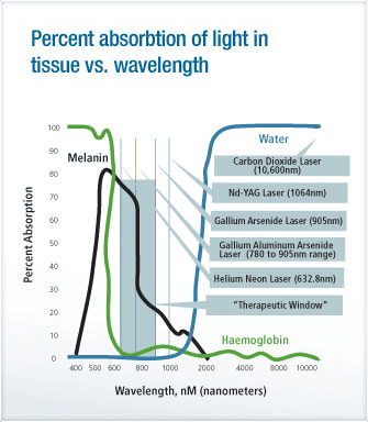 multi radiance laser