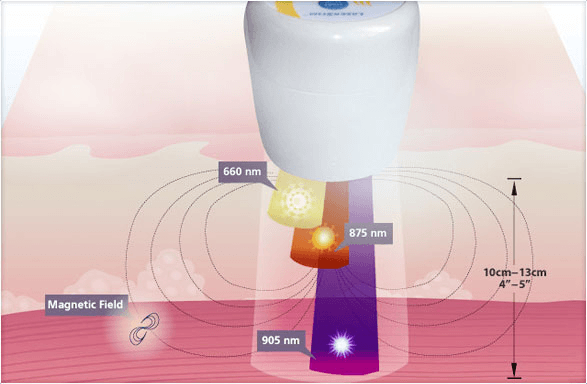 multi radiance laser
