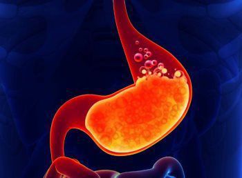 Acid Reflux And Heartburn