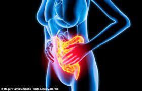 Irritable Bowel Syndrome