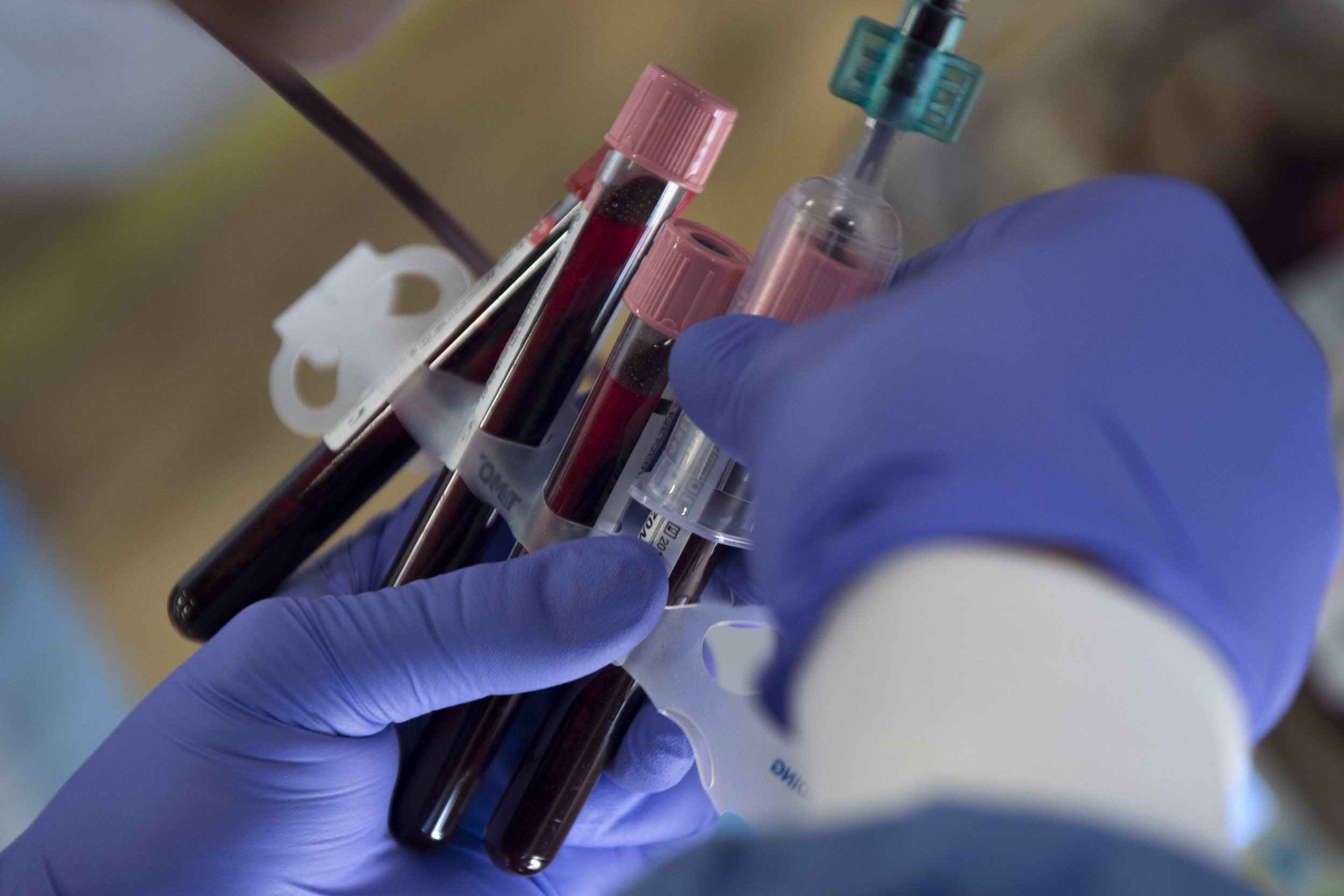 Sickle Cell Work REIMBURSEMENT Program