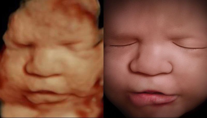 8K Image Enhancement