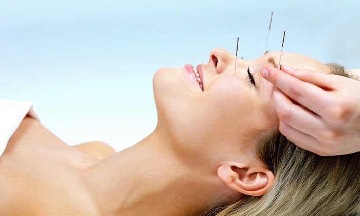 Acupuncture P.C.