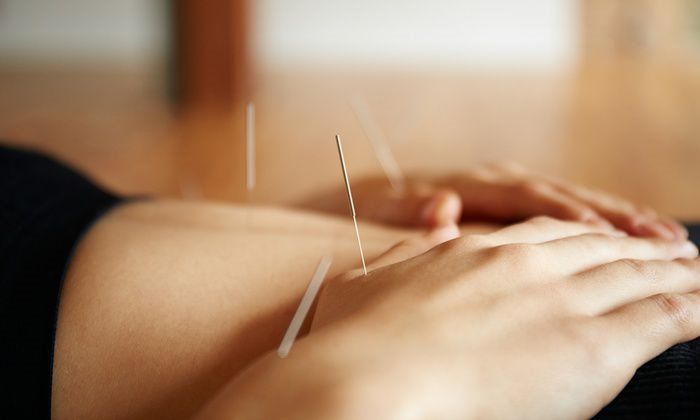 Acupuncture P.C.