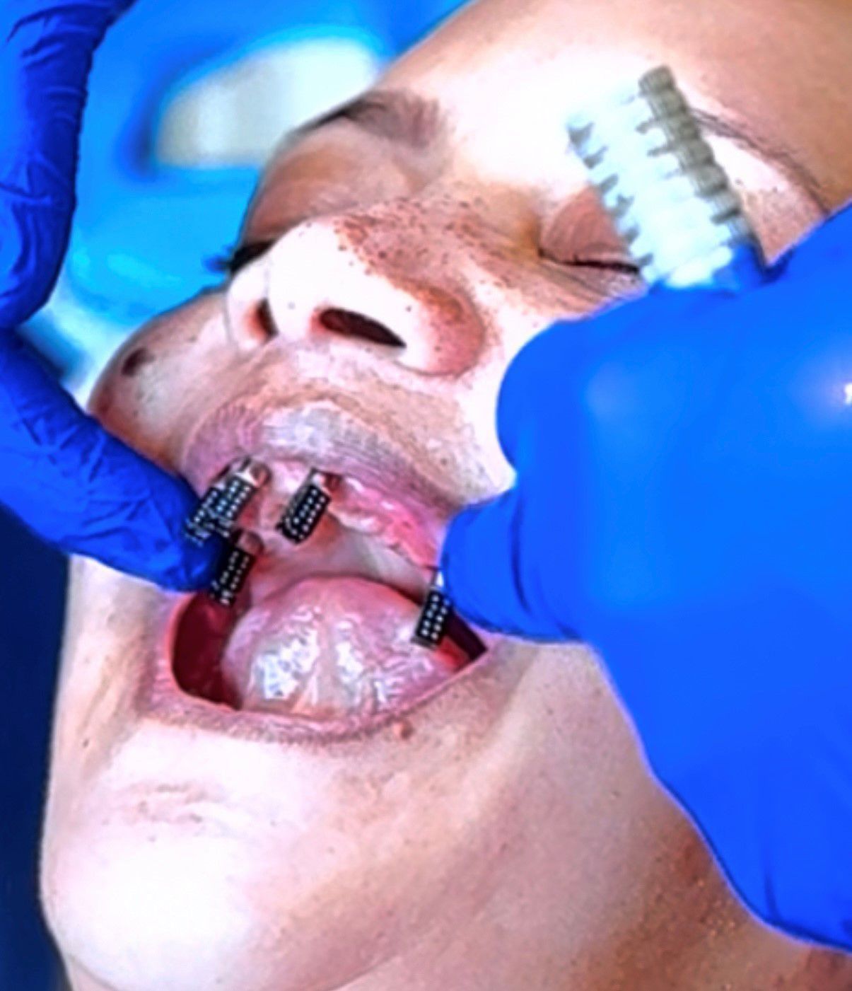 Dental