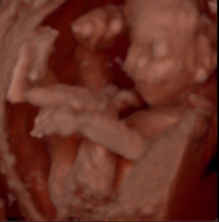 5D Gender Reveal